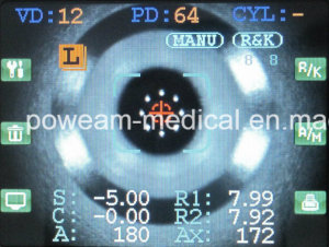 auto-refractometer-kerato-refr